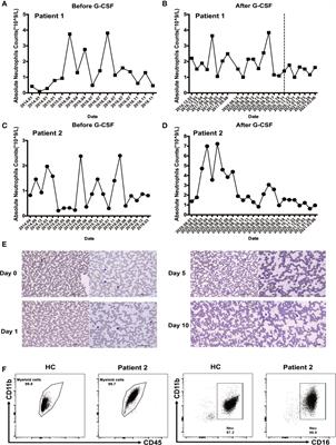 Altered Functions of Neutrophils in Two Chinese Patients With Severe Congenital Neutropenia Type 4 Caused by G6PC3 Mutations